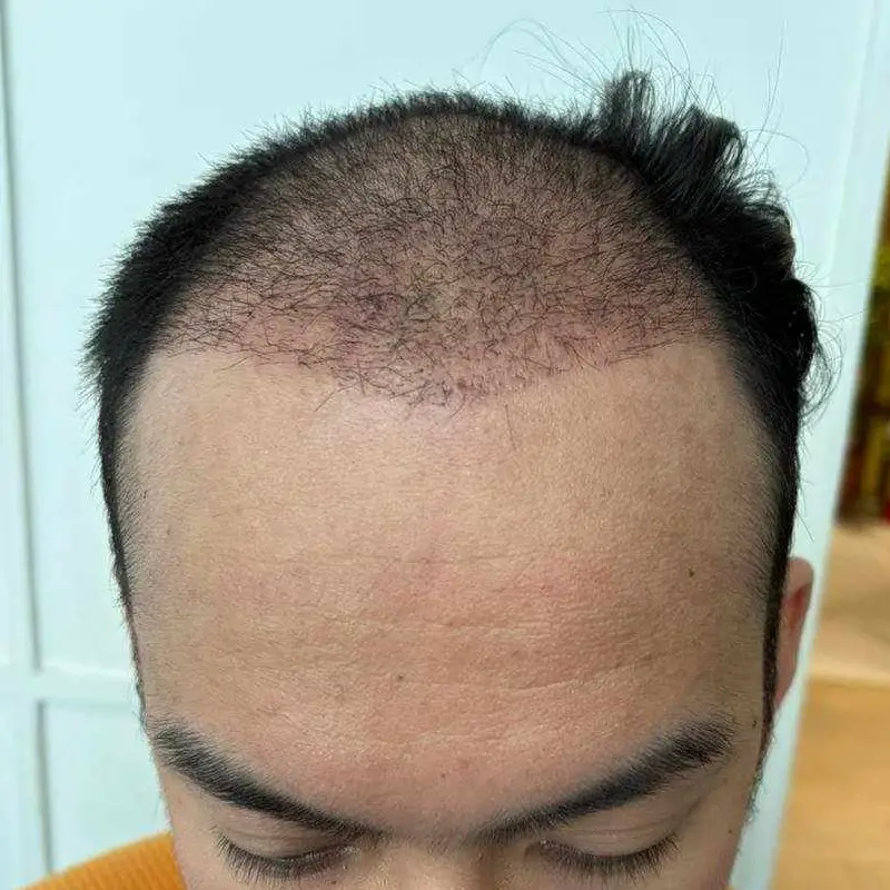 before-after1 before-after1